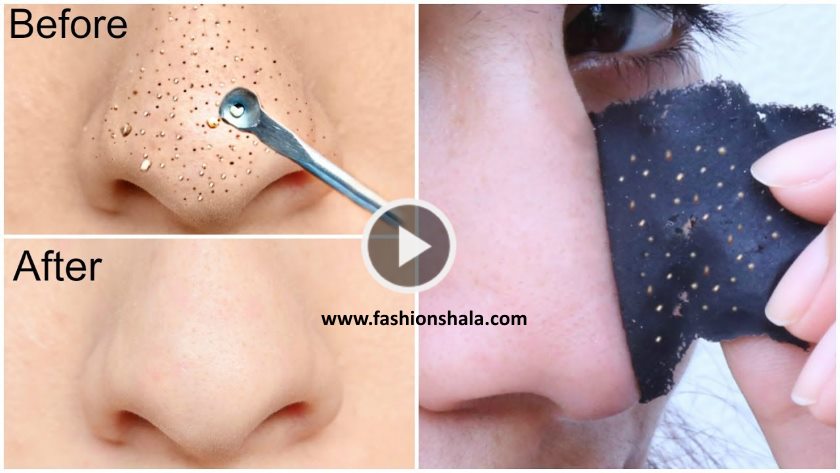 Easy DIY Blackhead Remover Peel Off Mask Instant Results