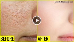 How to Get Rid of Large OPEN PORES Permanently - Ethnic Fashion