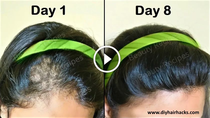 She turned her Thin hair to Thick hair in 1 week